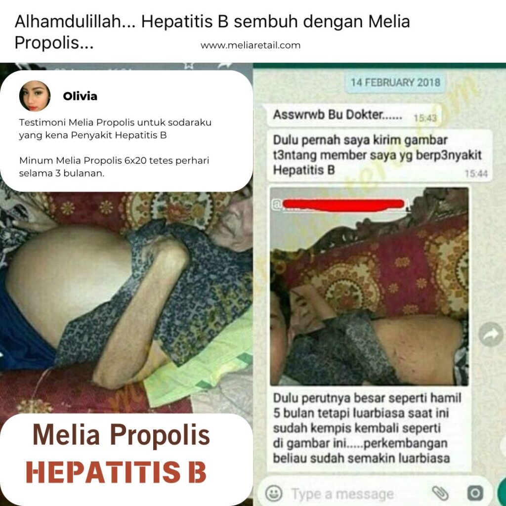 Testimoni Propolis Untuk Hepatitis B