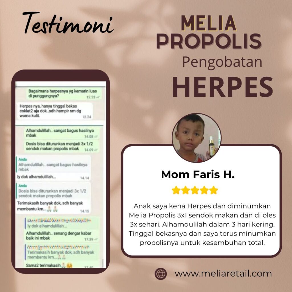 Testimoni Propolis Untuk Herpes