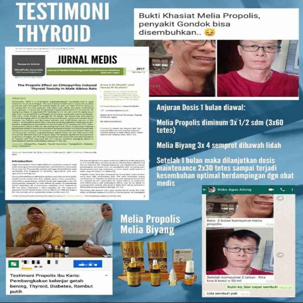 Testimoni Propolis Untuk Kelenjar Tyroid