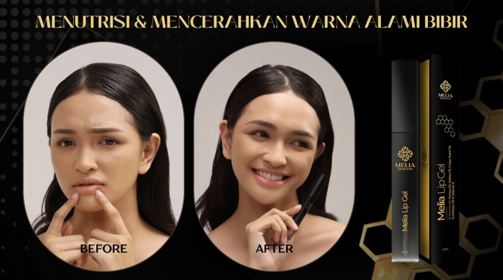 Review Melia Lip Gel